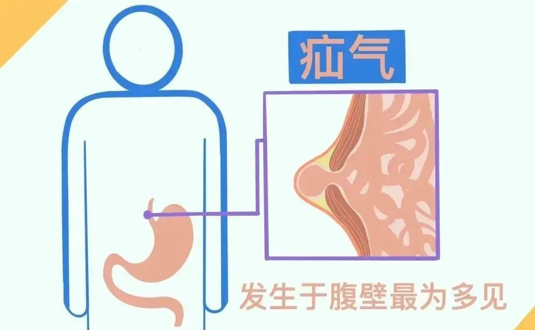 微信圖片_20220429142117.jpg 微信圖片_20220429142117.jpg